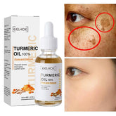 Turmeric™ Óleo Anti-Idade Removedor de Manchas - Ellegance DeLuxe