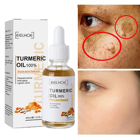 Turmeric™ Óleo Anti-Idade Removedor de Manchas - Ellegance DeLuxe