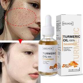 Turmeric™ Óleo Anti-Idade Removedor de Manchas - Ellegance DeLuxe